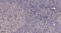 HCN2 Polyclonal Antibody