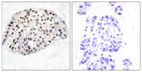 HDAC1 Polyclonal Antibody