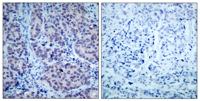 HDAC2 Polyclonal Antibody