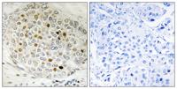 HDAC5 Polyclonal Antibody