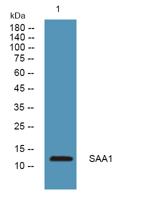 SAA1 Polyclonal Antibody