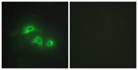 AK1 Polyclonal Antibody