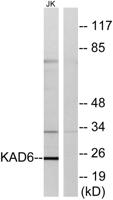AK6 Polyclonal Antibody