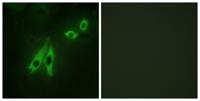 AKAP 110 Polyclonal Antibody