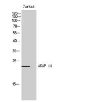 AKAP 14 Polyclonal Antibody