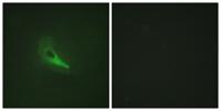 AKAP 250 Polyclonal Antibody