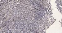 AKAP6 Polyclonal Antibody