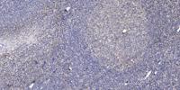 AKAP9 Polyclonal Antibody