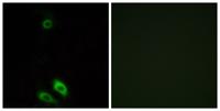 AKR1CL1 Polyclonal Antibody