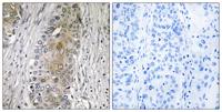 SAA4 Polyclonal Antibody