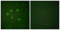 SAE1 Polyclonal Antibody