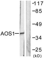 SAE1 Polyclonal Antibody