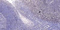 SAE1 Polyclonal Antibody