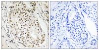 SAF-A2 Polyclonal Antibody