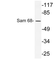 Sam 68 Polyclonal Antibody