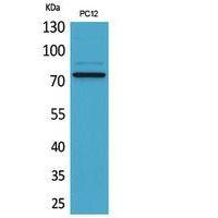 SAMHD1 Polyclonal Antibody
