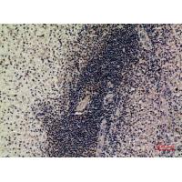 SAMHD1 Polyclonal Antibody