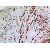 SAMHD1 Polyclonal Antibody