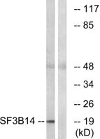 SAP 14 Polyclonal Antibody