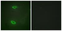 SAPAP1 Polyclonal Antibody