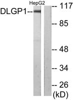 SAPAP1 Polyclonal Antibody