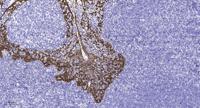 SAPAP1 Polyclonal Antibody