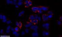 Saposin Polyclonal Antibody