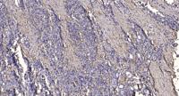 Saposin Polyclonal Antibody