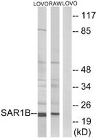 Sar1B Polyclonal Antibody