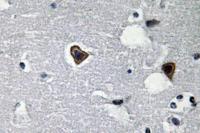 Sarcoglycan-β Polyclonal Antibody