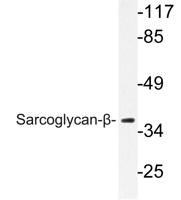 Sarcoglycan-β Polyclonal Antibody