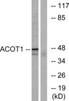 ACOT1 Polyclonal Antibody