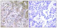ACOT12 Polyclonal Antibody