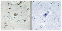 ACOT4 Polyclonal Antibody