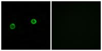 ACOT4 Polyclonal Antibody