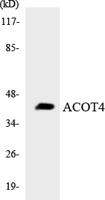 ACOT4 Polyclonal Antibody