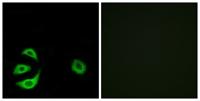 ACOT8 Polyclonal Antibody