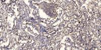 ACOT9 Polyclonal Antibody