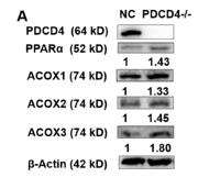 ACOX3 Polyclonal Antibody