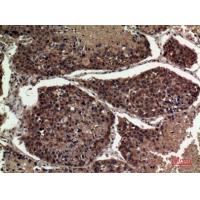 ApoA-I Polyclonal Antibody