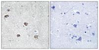 ACSL6 Polyclonal Antibody