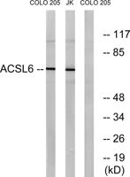 ACSL6 Polyclonal Antibody