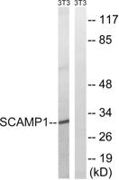 SCAMP1 Polyclonal Antibody