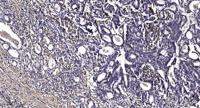 SCAMP1 Polyclonal Antibody