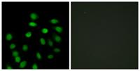 SCAND1 Polyclonal Antibody