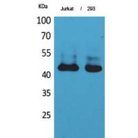 SCCA1/2 Polyclonal Antibody