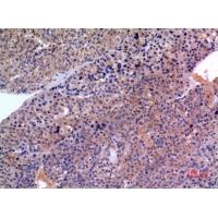 SCCA1/2 Polyclonal Antibody