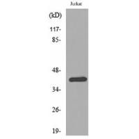 SCCA1/2 Polyclonal Antibody