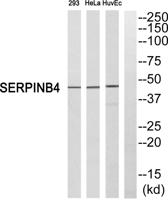 SCCA2 Polyclonal Antibody
