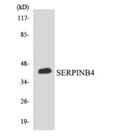 SCCA2 Polyclonal Antibody